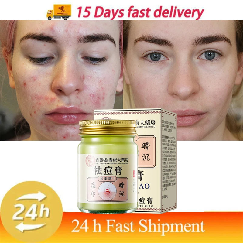 Body Acne Removal Cream Treatment Face Butt Back Acne Marks Smooth Repair Chicken Skin Cream Moisturizing Whitening Skin Care